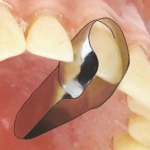 نوار ماتریکس قدامی فرم داده شده
Twin Anterior Matrices - مدل:1.523